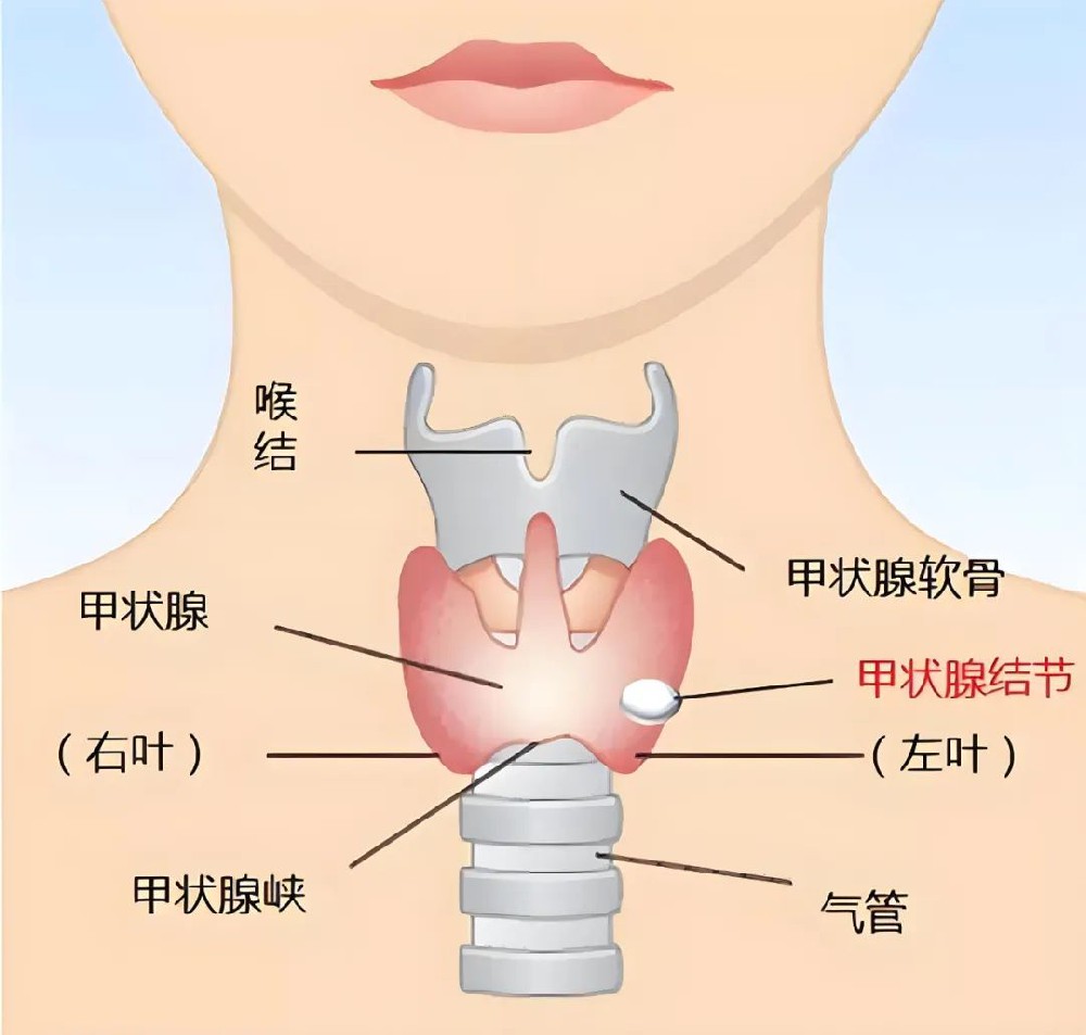 甲狀腺結(jié)節(jié)的中醫(yī)治療，您知道多少？